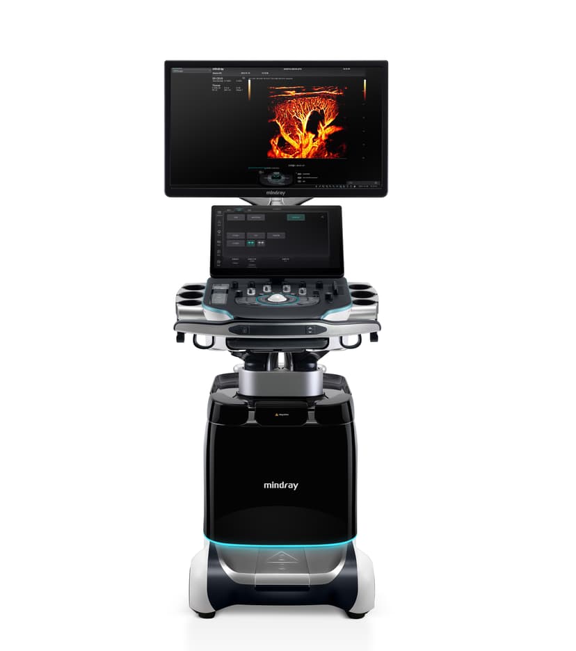 Ultrasound